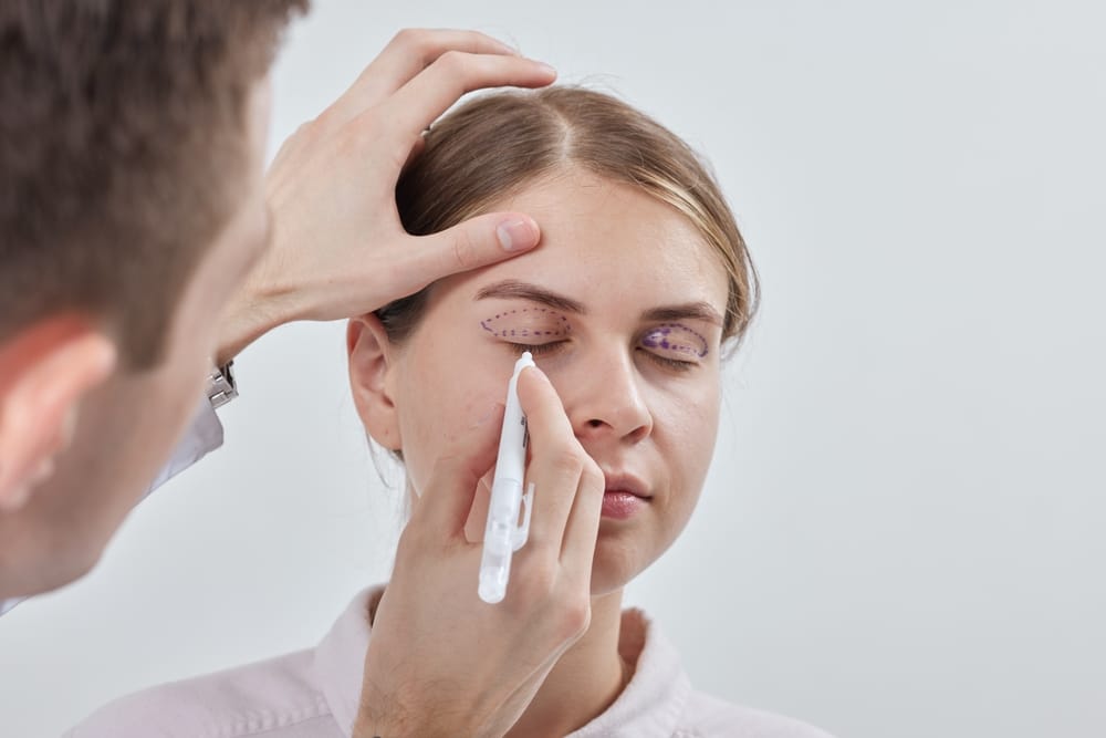 Woman having her eyelids drawn on in preparation for her blepharoplasty surgery.